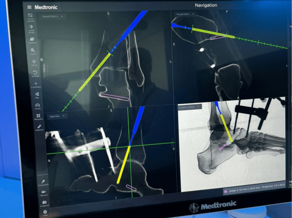 recherche et développement