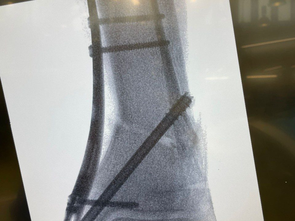 Congratulations to Dr. Lisca