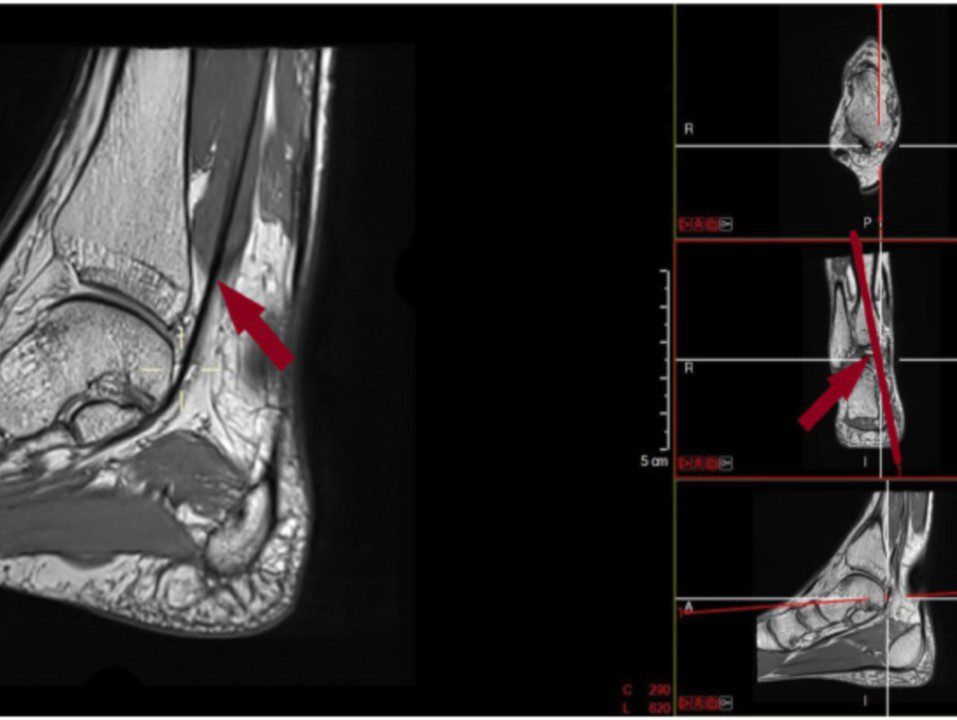 Les docteurs Nils Reymond