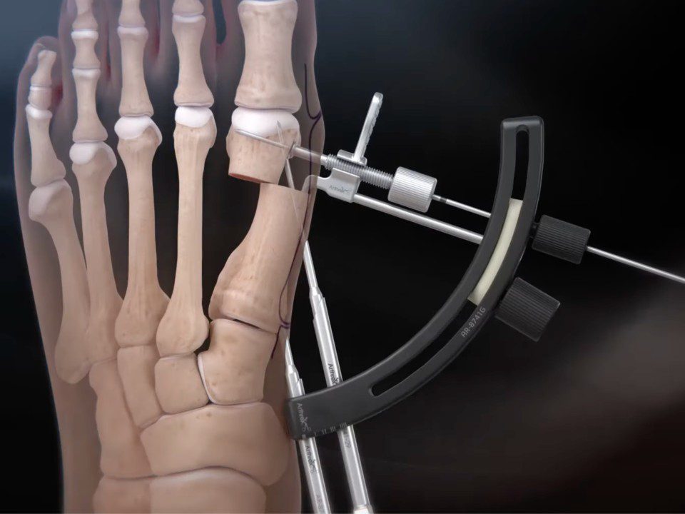 Guided Trajectory System