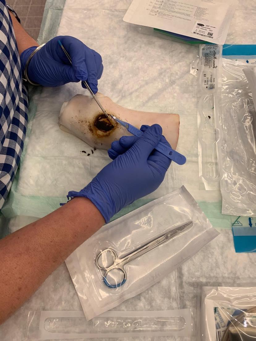 Ateliers Pied Diabétique