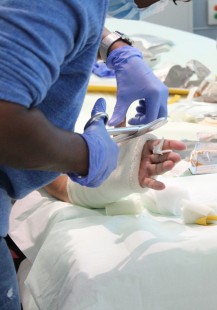 Plâtres et attelles