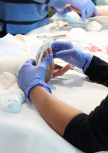 Plâtres et attelles