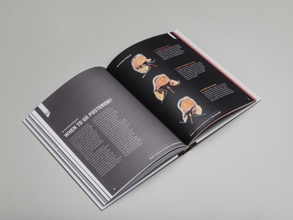 approche chirurgicale