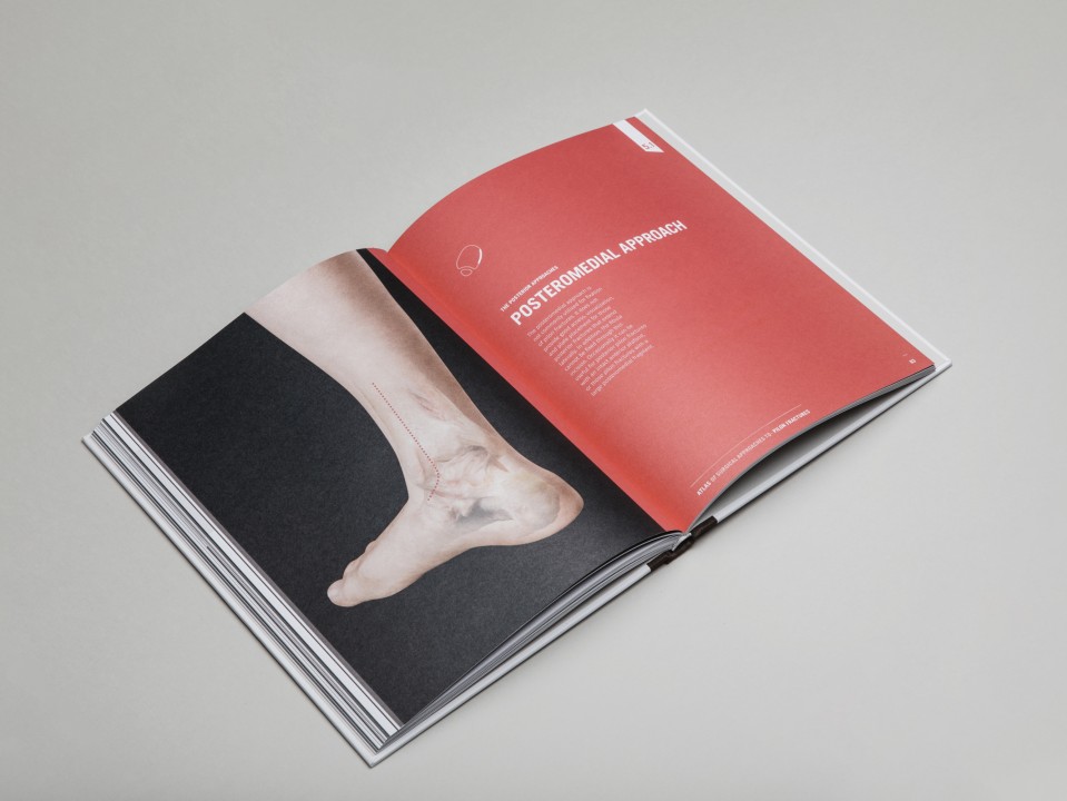 approche chirurgicale