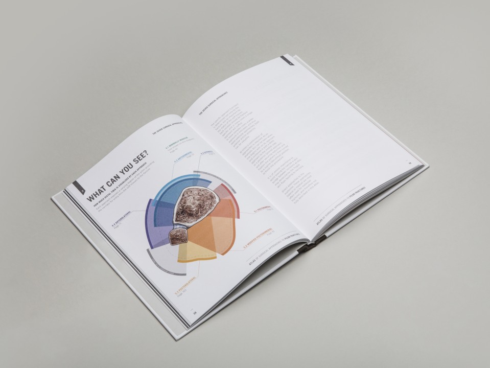 approche chirurgicale